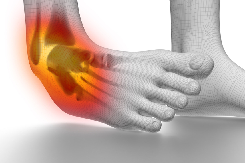 modul în care sportivii tratează artroza medicație de deformare articulară