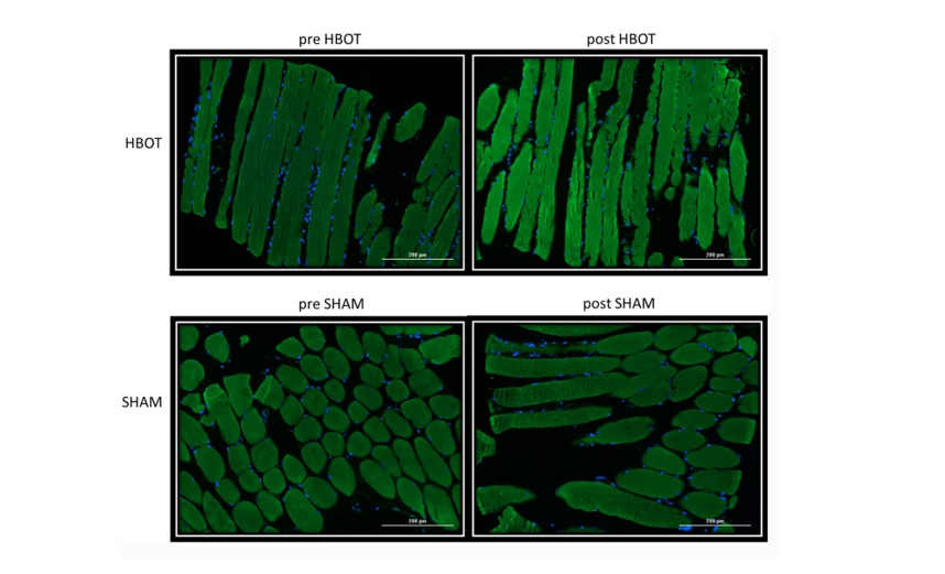 Modificari ale masei mitocondriale
