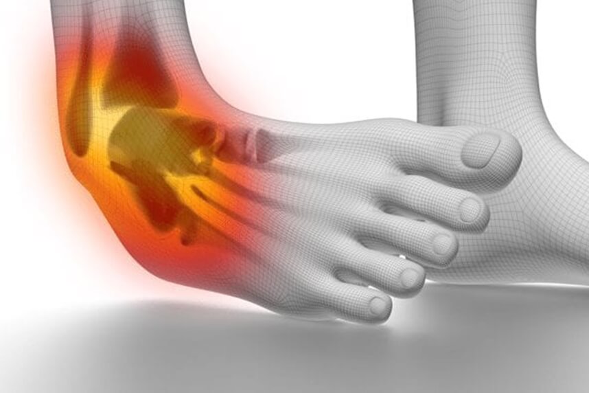 tratamentul leziunii ligamentului gleznei tratamentul plasmolifting al artrozei genunchiului
