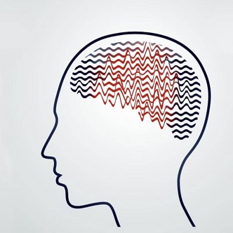 Stimularea electrica transcraniana