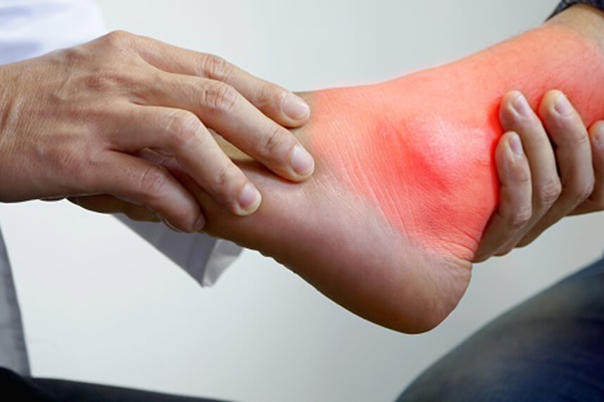 Cum să tratați gută piciorului: toate căile de a trata 