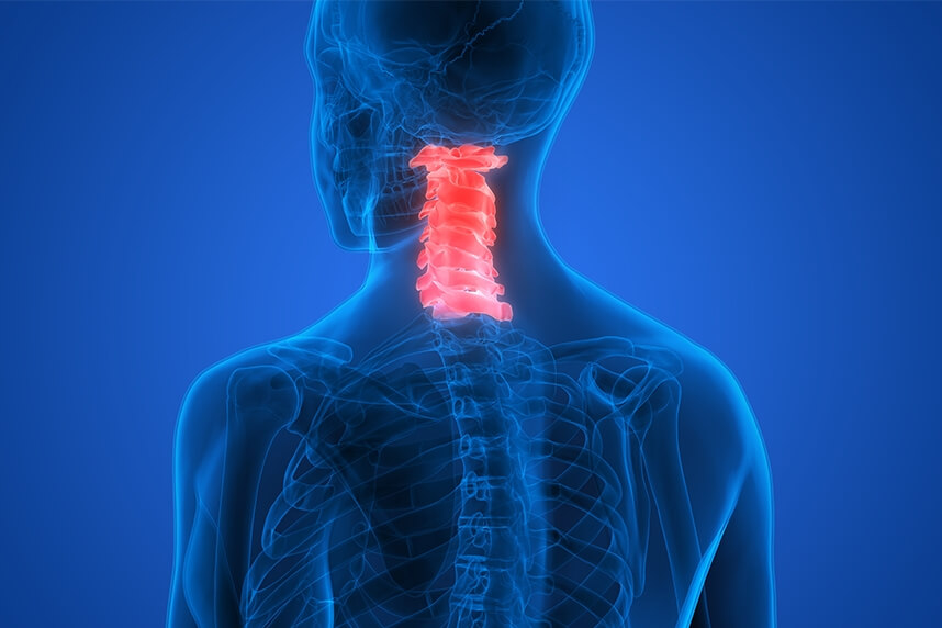 Boli degenerative articulare la nivelul coloanei vertebrale cervicale