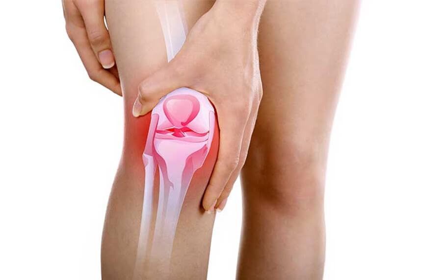 osteoartrita moderată a genunchiului durere de genunchi stânga drept