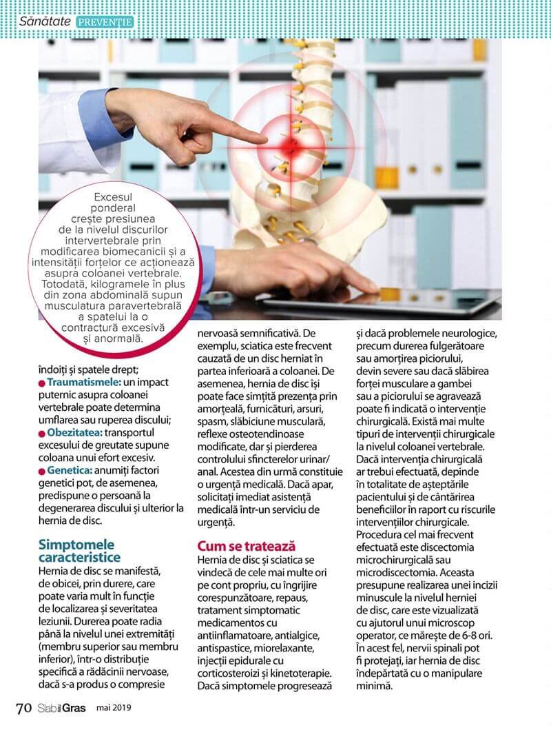 i.php?p=hernie-disc-2.jpg