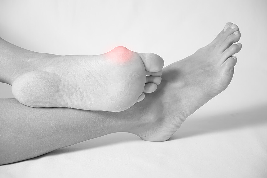 Poliartrită reumatoidă și durere la nivelul picioarelor
