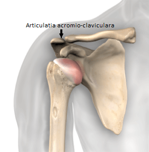 Artroza articulației acromio-claviculară - Durere în articulația acromială claviculară