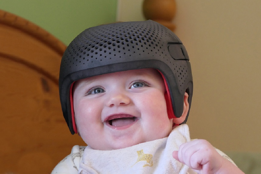 Torticolisul muscular Torticolisul muscular