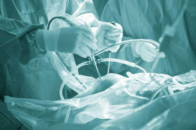 un chirurg poate trata artroza