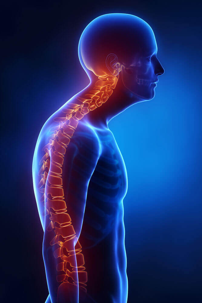 condroza coloanei vertebrale cervicale toracice durere constantă la nivelul articulațiilor
