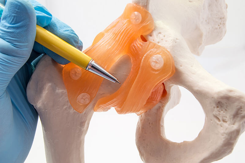 artroza șoldului 1 și 2 grade de tratament durerea articulară provoacă osteochondroză