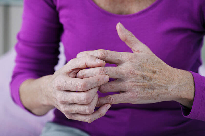 artrită reumatoidă durere de braț