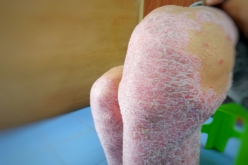 Articulatii Articulatii