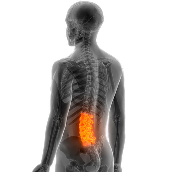 durere severă la nivelul coloanei vertebrale în zona lombară