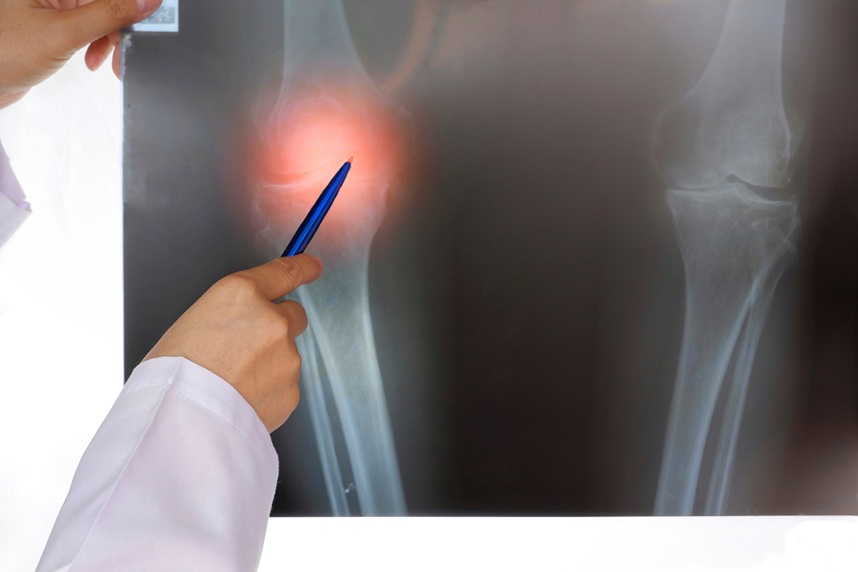 orthopedics ploiesti