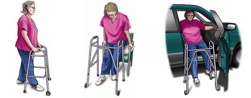 Recuperare artroplastie genunchi