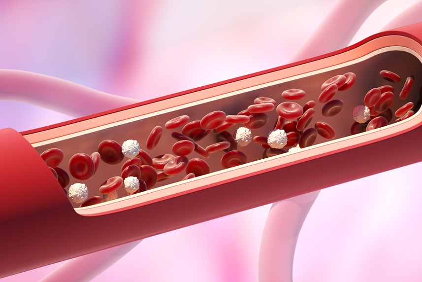 vascular surgery ploiesti vascular surgery ploiesti