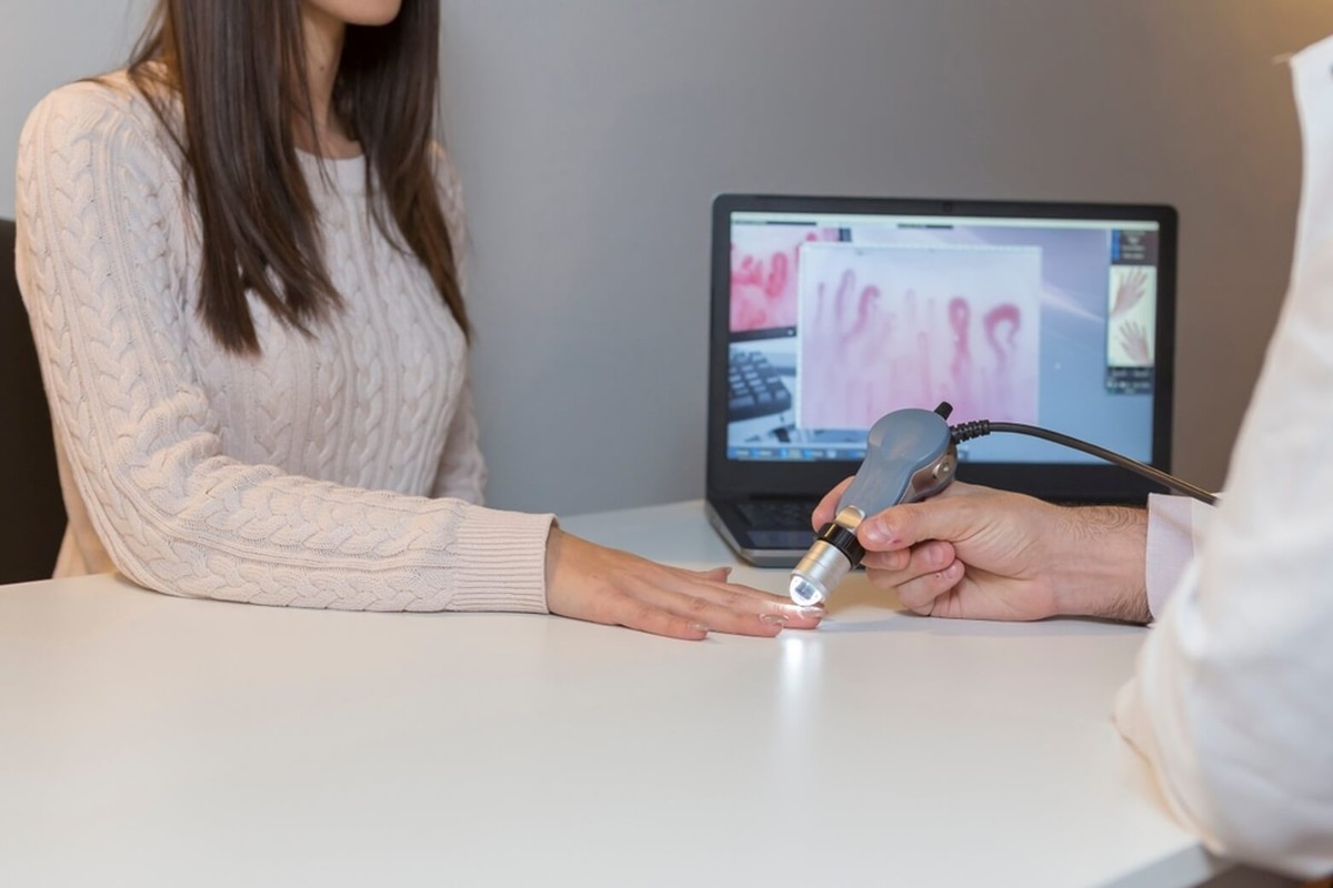 Capillaroscopy