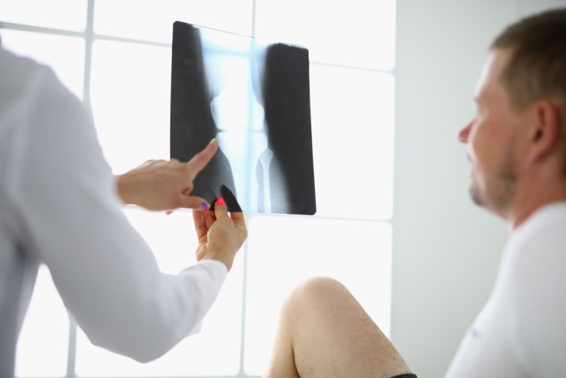 medic ii arata pacientului o radiografie