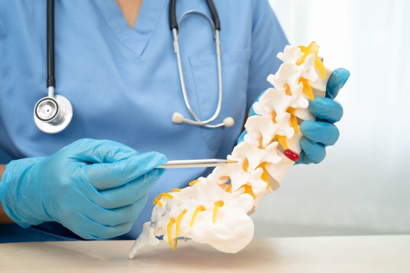 medic prezinta un model anatomic al coloanei