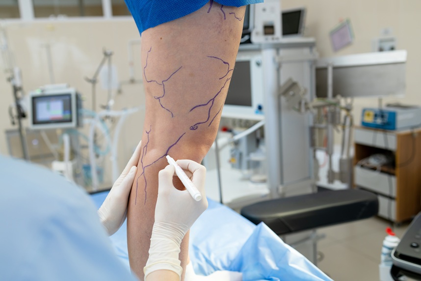 vascular surgery ploiesti vascular surgery ploiesti